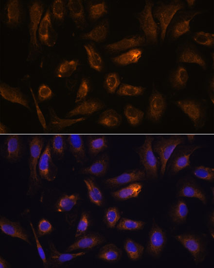 Immunofluorescence analysis of U-2 OS cells using RGS4 Polyclonal Antibody at dilution of  1:100. Blue: DAPI for nuclear staining.