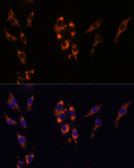 Immunofluorescence analysis of HeLa cells using PDE3A Polyclonal Antibody at dilution of  1:100 (40x lens). Blue: DAPI for nuclear staining.