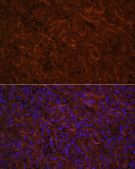 Immunofluorescence analysis of Human spleen using ICOS Polyclonal Antibody at dilution of  1:100. Blue: DAPI for nuclear staining.