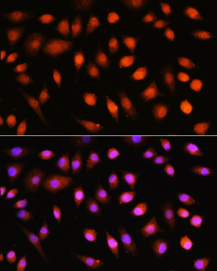 Immunofluorescence analysis of L929 cells using Pan-AKT Polyclonal Antibody at dilution of  1:100. Blue: DAPI for nuclear staining.