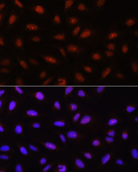 Immunofluorescence analysis of U-2 OS cells using Pan-AKT Polyclonal Antibody at dilution of  1:100. Blue: DAPI for nuclear staining.