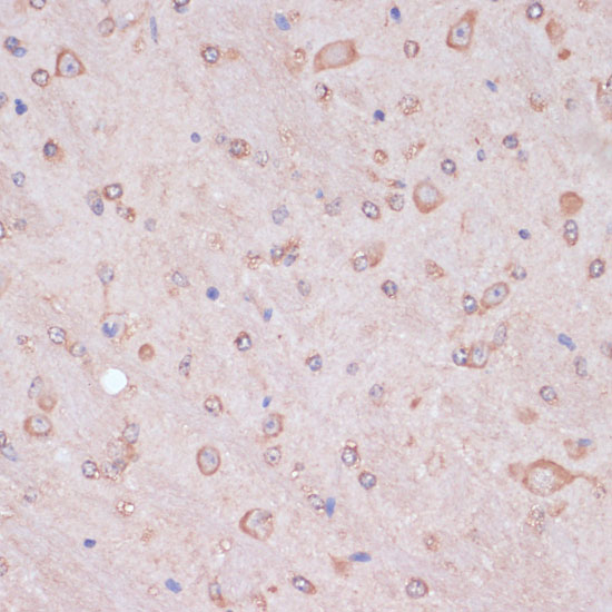 Immunohistochemistry of paraffin-embedded Mouse brain using CARTPT Polyclonal Antibody at dilution of  1:100 (40x lens).