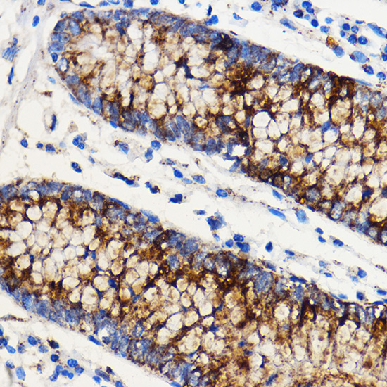 Immunohistochemistry of paraffin-embedded Human colon using NOTCH1 Polyclonal Antibody at dilution of  1:100 (40x lens).