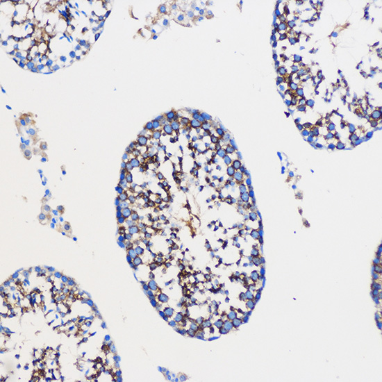 Immunohistochemistry of paraffin-embedded Mouse testis using NOTCH1 Polyclonal Antibody at dilution of  1:100 (20x lens).