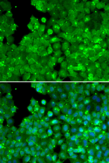 Immunofluorescence analysis of U2OS cells using IL10RA Polyclonal Antibody