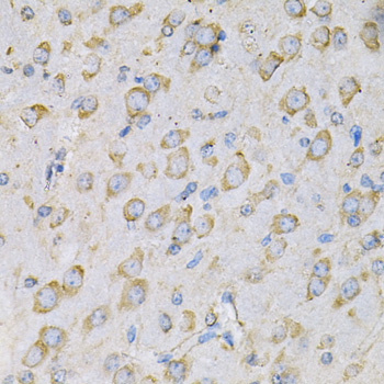 Immunohistochemistry of paraffin-embedded Rat brain using IL10RA Polyclonal Antibody at dilution of  1:100 (40x lens).