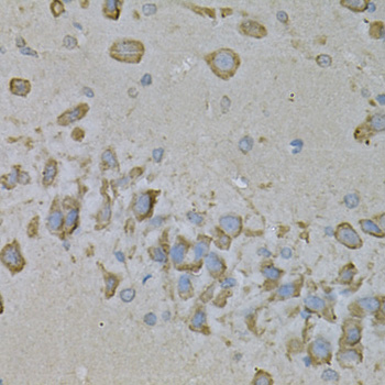 Immunohistochemistry of paraffin-embedded Mouse brain using IL10RA Polyclonal Antibody at dilution of  1:100 (40x lens).