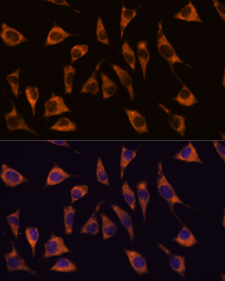 Immunofluorescence analysis of L929 cells using GPR22 Polyclonal Antibody at dilution of  1:100. Blue: DAPI for nuclear staining.