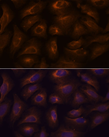 Immunofluorescence analysis of U-2 OS cells using GPR22 Polyclonal Antibody at dilution of  1:100. Blue: DAPI for nuclear staining.