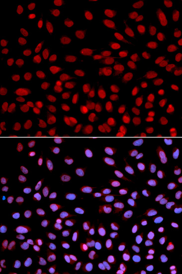 Immunofluorescence analysis of U2OS cells using DNA polymerase eta Polyclonal Antibody