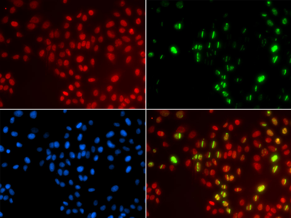 Immunofluorescence analysis of GFP-RNF168 transgenic U2OS cells using DNA polymerase eta Polyclonal Antibody