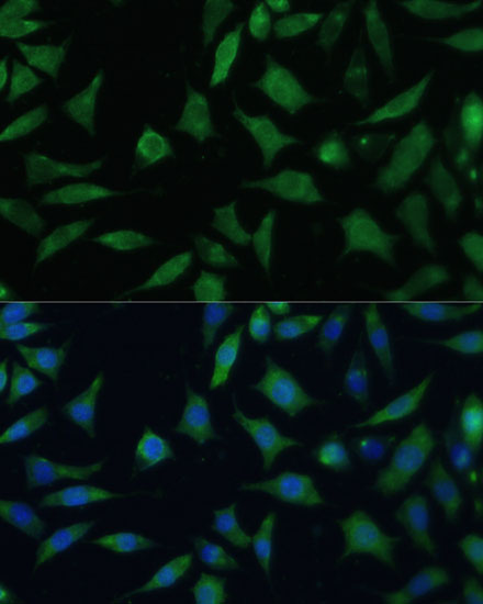 Immunofluorescence analysis of L929 cells using CD47 Polyclonal Antibody at dilution of  1:100. Blue: DAPI for nuclear staining.