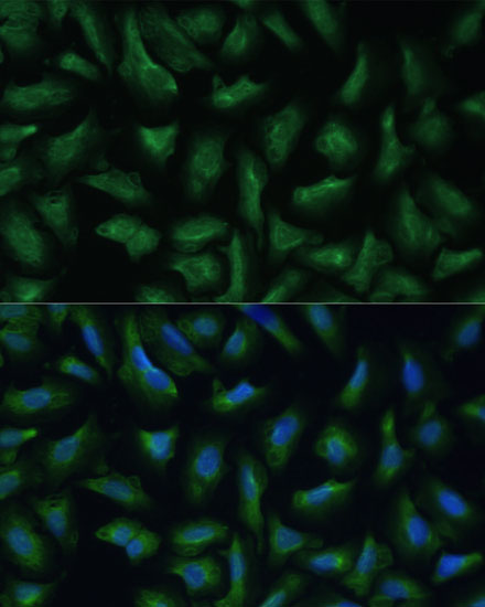 Immunofluorescence analysis of U-2 OS cells using CD47 Polyclonal Antibody at dilution of  1:100. Blue: DAPI for nuclear staining.