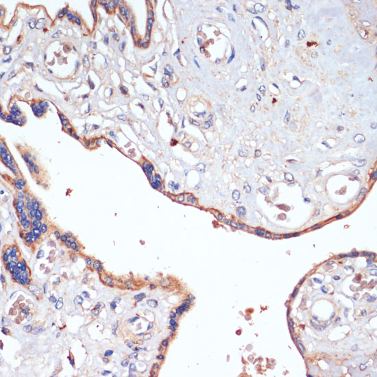 Immunohistochemistry of paraffin-embedded Human placenta using CD47 Polyclonal Antibody at dilution of  1:200 (40x lens).
