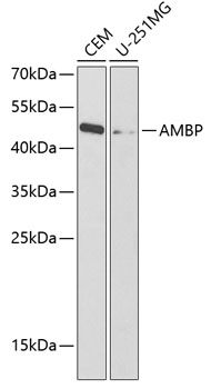 Western blot analysis of extracts of various cell lines using AMBP Polyclonal Antibody at dilution of 1:1000.