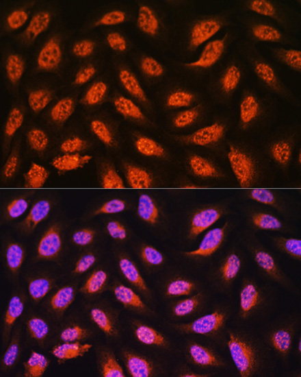 Immunofluorescence analysis of U2OS cells using PNPO Polyclonal Antibody at dilution of  1:100. Blue: DAPI for nuclear staining.