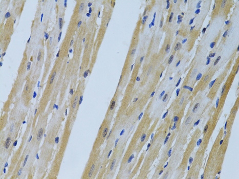 Immunohistochemistry of paraffin-embedded Mouse heart using FHL2 Polyclonal Antibody at dilution of  1:100 (40x lens).