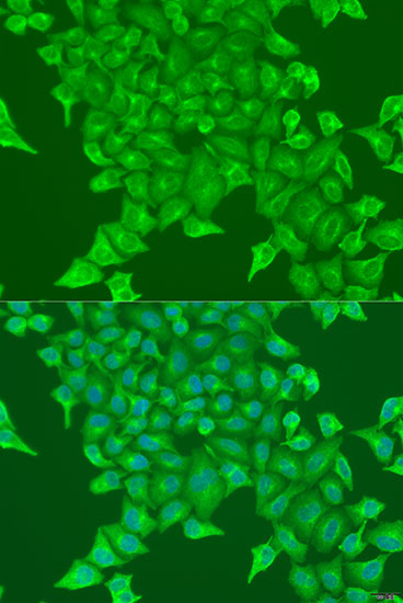 Immunofluorescence analysis of U2OS cells using BST2 Polyclonal Antibody at dilution of  1:100. Blue: DAPI for nuclear staining.
