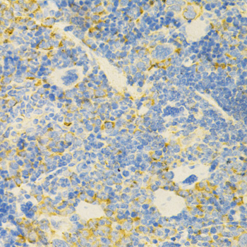 Immunohistochemistry of paraffin-embedded Mouse spleen using GPX4 Polyclonal Antibody at dilution of  1:200 (40x lens).