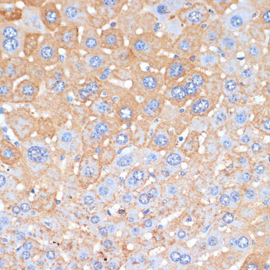 Immunohistochemistry of paraffin-embedded Mouse liver using APCS Polyclonal Antibody at dilution of  1:100 (40x lens).