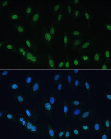 Immunofluorescence analysis of U-2 OS cells using Histone H2AX Polyclonal Antibody at dilution of  1:100 (40x lens). Blue: DAPI for nuclear staining.