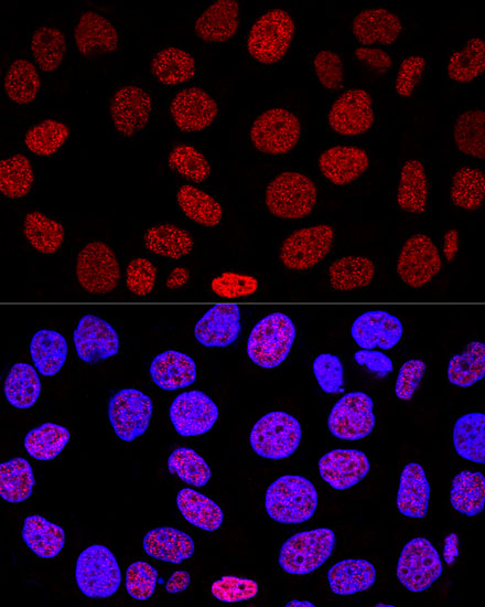 Confocal immunofluorescence analysis of HeLa cells using Histone H2AX Polyclonal Antibody at dilution of  1:200. Blue: DAPI for nuclear staining.