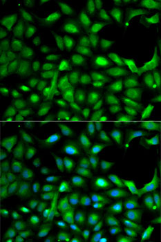 Immunofluorescence analysis of A-549 cells using IGF2 Polyclonal Antibody