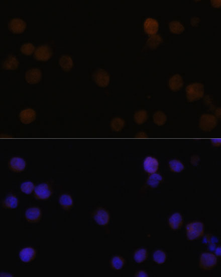 Immunofluorescence analysis of Y79 cells using Rb Polyclonal Antibody at dilution of  1:100. Blue: DAPI for nuclear staining.