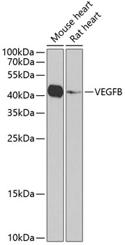 Western blot analysis of extracts of various cell lines using VEGFB Polyclonal Antibody at dilution of 1:1000.