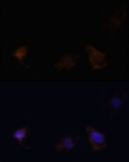 Immunofluorescence analysis of C6 cells using ZYX Polyclonal Antibody at dilution of  1:100. Blue: DAPI for nuclear staining.