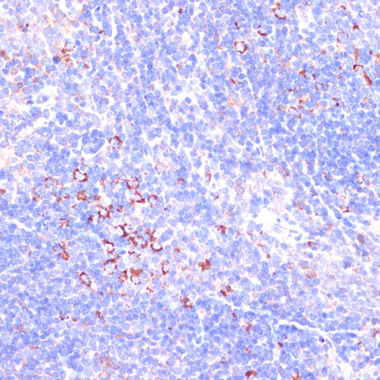 Immunohistochemistry of paraffin-embedded Mouse spleen using ZYX Polyclonal Antibody at dilution of  1:100 (40x lens).