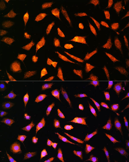 Immunofluorescence analysis of L929 cells using BNP Polyclonal Antibody at dilution of  1:100. Blue: DAPI for nuclear staining.