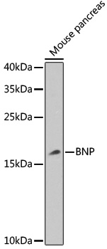 Western blot analysis of extracts of Mouse pancreas using BNP Polyclonal Antibody at dilution of 1:1000.