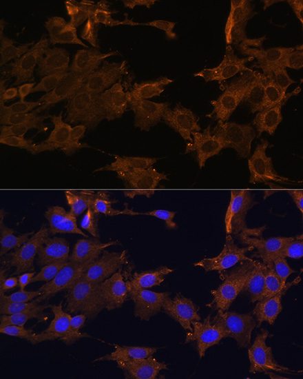 Immunofluorescence analysis of C6 cells using PDGFR beta Polyclonal Antibody at dilution of  1:100. Blue: DAPI for nuclear staining.