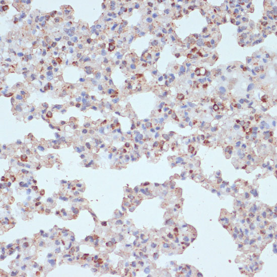 Immunohistochemistry of paraffin-embedded Rat lung using PDGFR beta Polyclonal Antibody at dilution of  1:100 (40x lens).