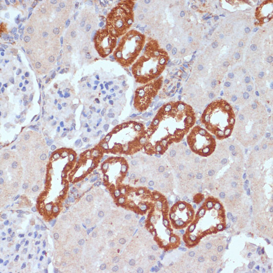 Immunohistochemistry of paraffin-embedded Rat kidney using PDGFR beta Polyclonal Antibody at dilution of  1:100 (40x lens).