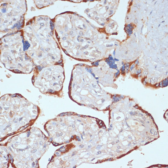 Immunohistochemistry of paraffin-embedded Human placenta using PDGFR beta Polyclonal Antibody at dilution of  1:100 (40x lens).