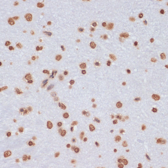 Immunohistochemistry of paraffin-embedded Rat brain using Histone H3 Polyclonal Antibody at dilution of  1:100 (40x lens).