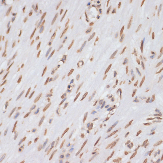 Immunohistochemistry of paraffin-embedded Human appendix using Histone H3 Polyclonal Antibody at dilution of  1:100 (40x lens).