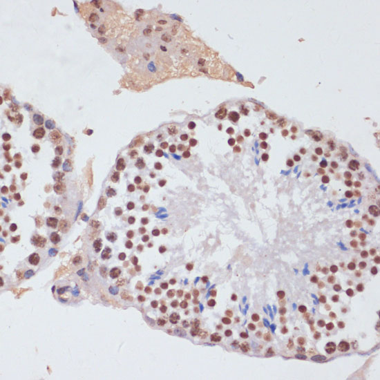 Immunohistochemistry of paraffin-embedded Mouse testis using Histone H3 Polyclonal Antibody at dilution of  1:100 (40x lens).