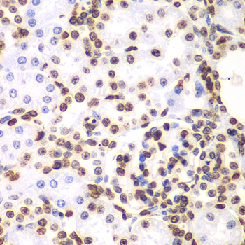 Immunohistochemistry of paraffin-embedded Rat kidney using Histone H3 Polyclonal Antibody at dilution of  1:100 (40x lens).