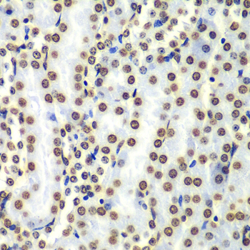 Immunohistochemistry of paraffin-embedded Mouse kidney using Histone H3 Polyclonal Antibody at dilution of  1:100 (40x lens).