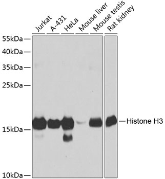 Western blot analysis of extracts of various cell lines using Histone H3 Polyclonal Antibody at dilution of 1:1000.