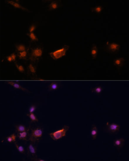 Immunofluorescence analysis of C6 cells using BRCA2 Polyclonal Antibody at dilution of  1:100. Blue: DAPI for nuclear staining.