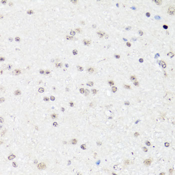 Immunohistochemistry of paraffin-embedded Mouse brain using c-Fos Polyclonal Antibody at dilution of  1:150 (40x lens).