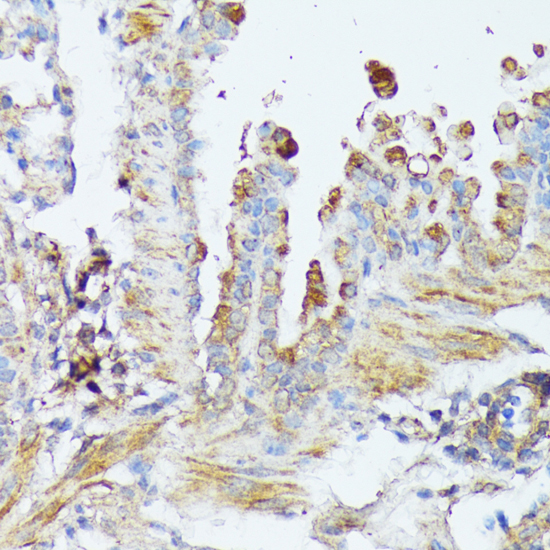 Immunohistochemistry of paraffin-embedded Mouse lung using WNT1 Polyclonal Antibody at dilution of  1:100 (40x lens).