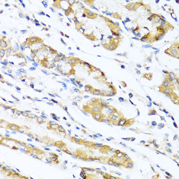 Immunohistochemistry of paraffin-embedded Human stomach using LYZ Polyclonal Antibody at dilution of  1:100 (40x lens).