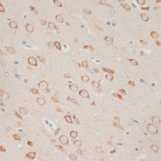 Immunohistochemistry of paraffin-embedded Rat brain using AXIN2 Polyclonal Antibody at dilution of  1:100 (40x lens).