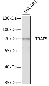 Western blot analysis of extracts of OVCAR3 cells using TRAF5 Polyclonal Antibody at dilution of 1:1000.