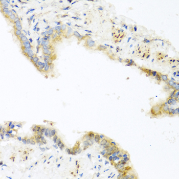 Immunohistochemistry of paraffin-embedded Mouse lung using RETN Polyclonal Antibody at dilution of  1:100 (40x lens).